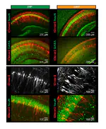 Glutamatergic drive along the septo-temporal axis of hippocampus boosts prelimbic oscillations in the neonatal mouse