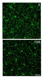 Sleep Loss Promotes Astrocytic Phagocytosis and Microglial Activation in Mouse Cerebral Cortex