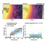 Neural Correlates of Anesthesia in Newborn Mice and Humans