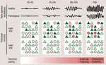 Prefrontal Cortex Development in Health and Disease: Lessons from Rodents and Humans