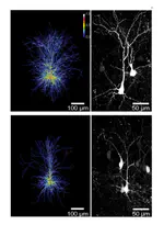 Resolving and Rescuing Developmental Miswiring in a Mouse Model of Cognitive Impairment