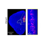 Transient Knock-Down of Prefrontal DISC1 in Immune-Challenged Mice Causes Abnormal Long-Range Coupling and Cognitive Dysfunction throughout Development