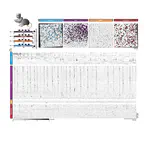 Anesthetics fragment hippocampal network activity, alter spine dynamics, and affect memory consolidation